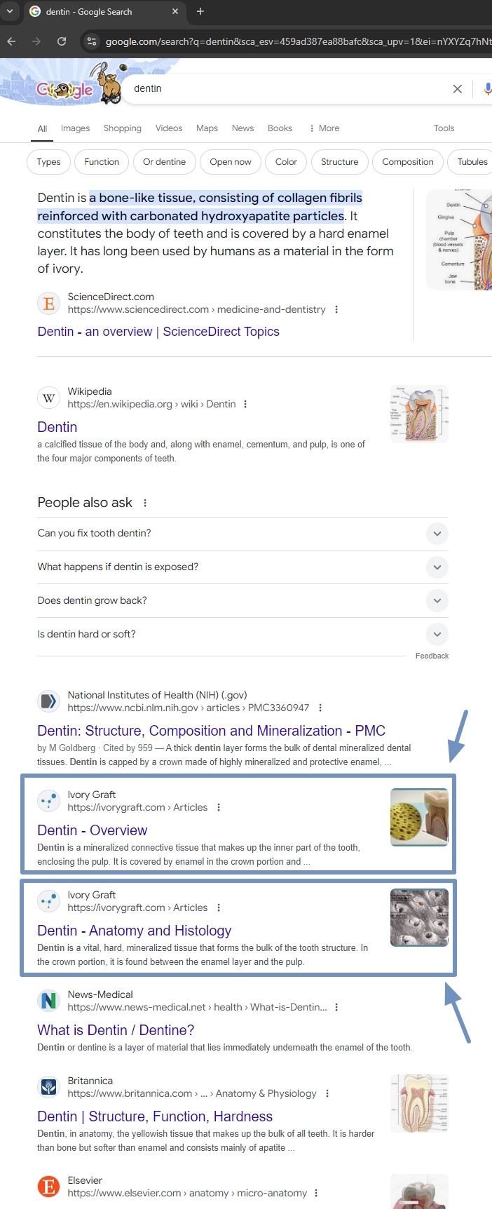 Dentin by Ivory Graft - Google serch results