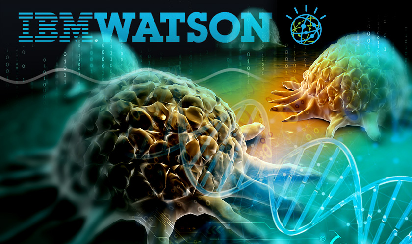 Watson  IBM 